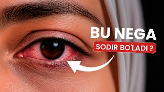 Koʻz qizarishi sabablari va koʻz qizarganda birinchi boʻlib nima qilish kerak? Shifokor maslahati.