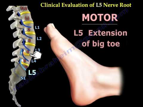 low-back-pain-lumbar-disc-herniation---everything-you-need-to-know---dr.-nabil-ebraheim