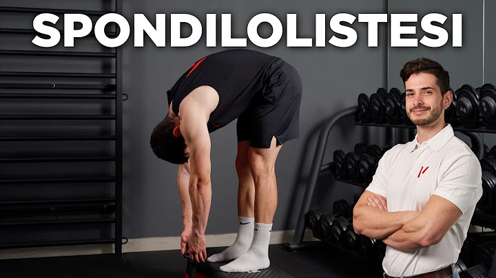 SPONDILOLISTESI: la GUIDA COMPLETA