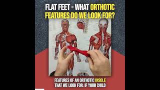 Flat Feet -  What Orthotic Features Do We Look For