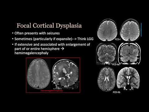 imaging Congenital malformation