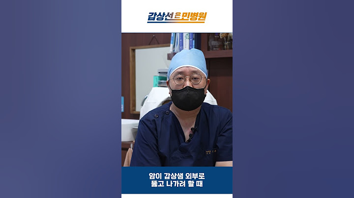 전이없는 암, 전이가 생긴암, 치료 차원이 달라요
