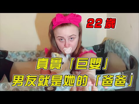 22歲的「巨嬰」，每天穿紙尿褲睡嬰兒床｜巨嬰｜明星觀察員