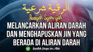 RUQYAH MELANCARKAN PEREDARAN DARAH DAN MENGHAPUSKAN JIN YANG BERADA DI ALIRAN PEREDARAN DARAH