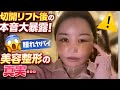 切開リフトDT顔でインライしたら質問いっぱいきた