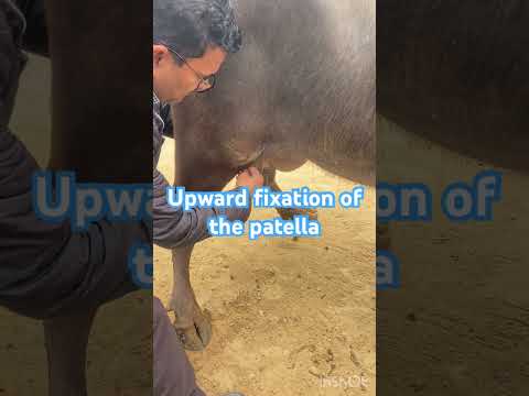Upward fixation of