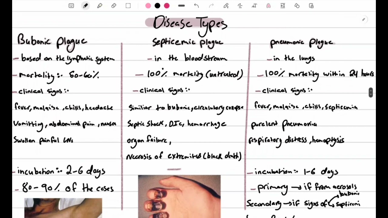 ✅HLS Microbiology Yersinia pestis