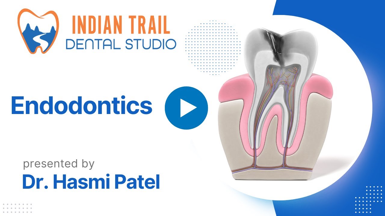 What Is Endodontics? Indian Trail Dental YouTube