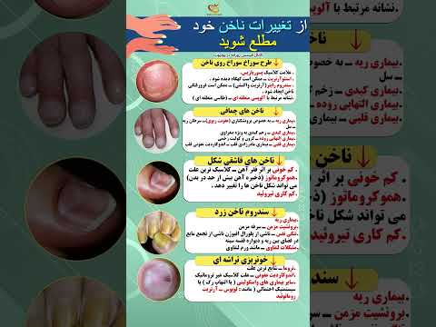 ۵ تغییر ناخن که نشان دهنده مشکلات بزرگ سلامتی هستند