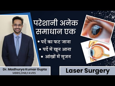 परदे में होने वाले ऑपरेशन के बारे में जानिए !  Dr. Madhurya Kumar Gupta #eyecare