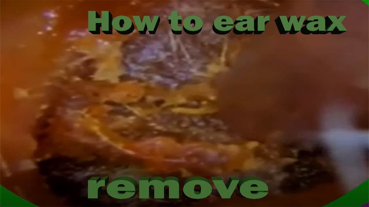 Failure to remove the wax in its ear can cause deafnessEP316 YouTube