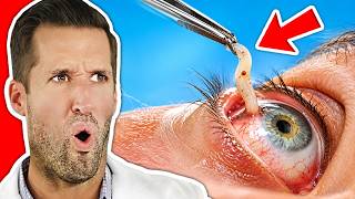 ER Doctor REACTS to Deadliest Parasites Found Inside Humans #5