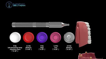 M6 Dental locator attachment workflow display