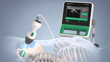 Verathon BladderScan Prime Portable Ultrasound Instrument