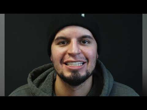 Smile makeover case