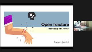 Open fracture: Practical Point for GP screenshot 4