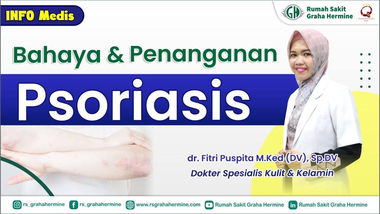 Bahaya dan Penanganan Psoriasis