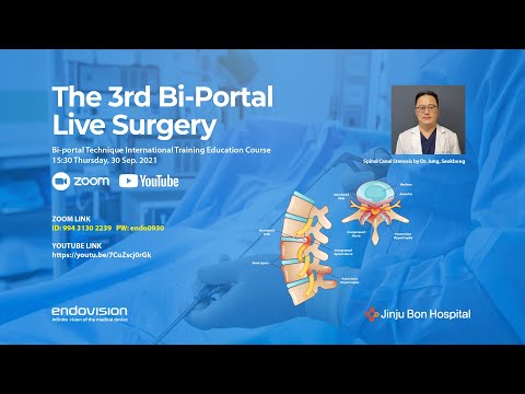 3rd Bi-portal Spine Endoscopic Live Surgery by Endovision