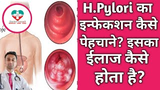 H.pylori Details H.pylori क इनफकशन कस पहचन? इसक ईलज कय ह?