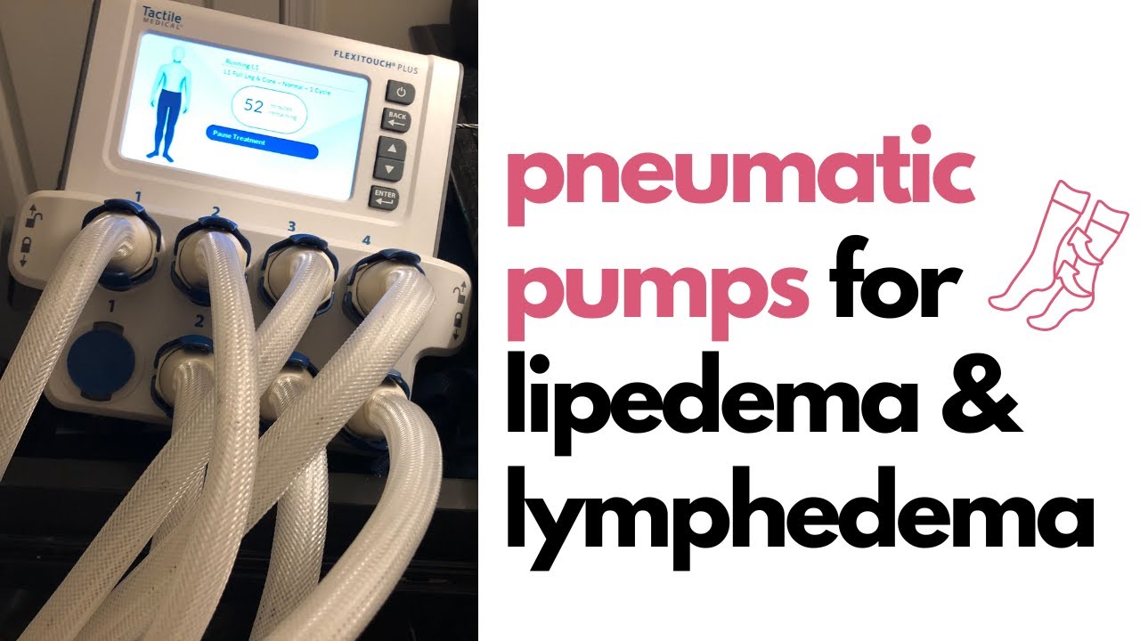 Using a Pneumatic Pump for Lipedema and Lymphedema 
