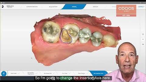 Tip of the Day: Insertion Axis and Sprue Position