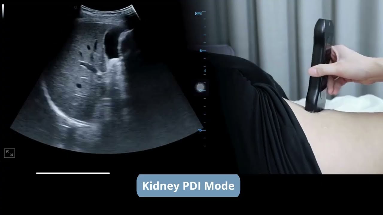 Onsound 3 en 1: Lineal, Convexo y Sectorial