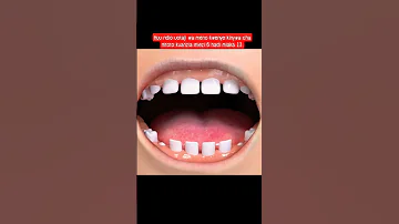 Uotaji Sahihi Wa Meno Kuanzia Mtoto Miezi 6 Hadi Miaka 14 Dentist Teeth Dental 