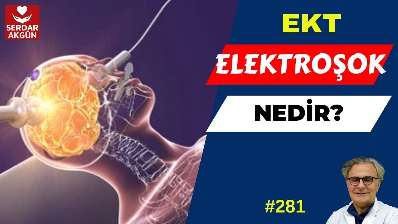 281. Elektroşok nedir? Kimlere ve nasıl uygulanır? Serdar Akgün