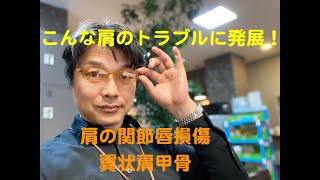肩のトラブル：肩の関節唇損傷の代償が引き起こした翼状肩甲骨