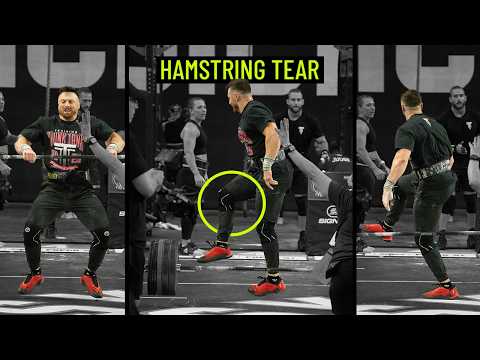 Injury Forced Them to Level Up (Here's What They Gained) | EP. 247
