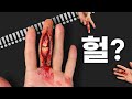 헐? 뼈가보이네? 징그럽다고 난리난 뼈툭튀 손가락