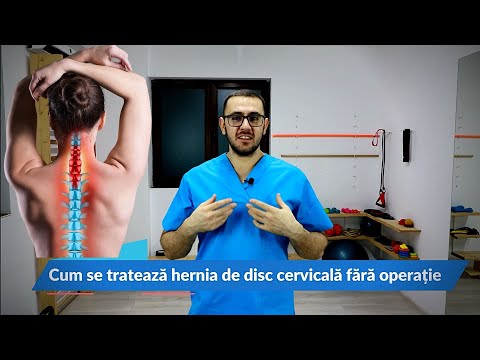 Video: Hernia Coloanei Cervicale - Simptome, Tratament, Exerciții