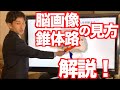 【分かりやすい！】脳画像・錐体路をこれで理解！