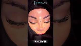 Fox Eye Surgery - Estheticland #cosmeticsurgery