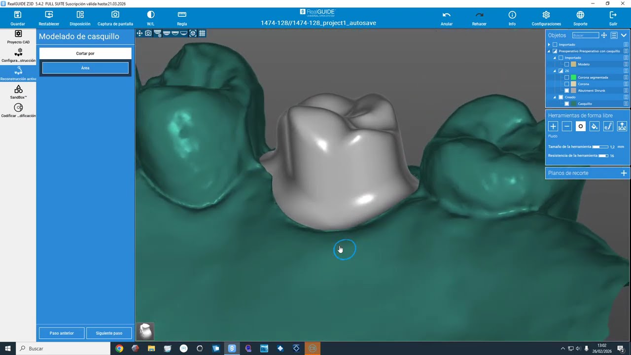 Provisional inmediato 