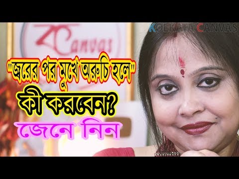 ভিডিও: সবাই মুখ ফিরিয়ে গেলে কী করবেন