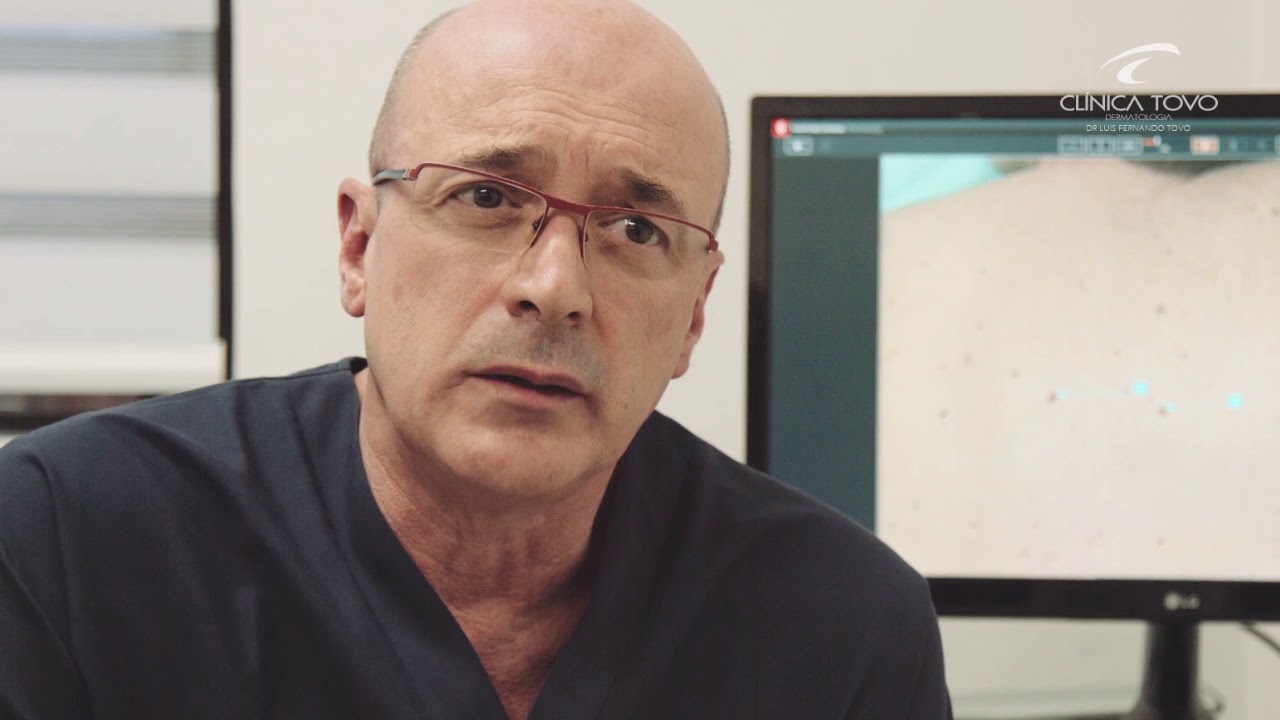 dr tovo luis fernando tovo clinica tovo dermatologia dermatoscopia digital e mapeamento corporal
