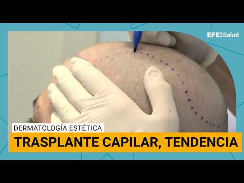 El trasplante de pelo, tendencia social