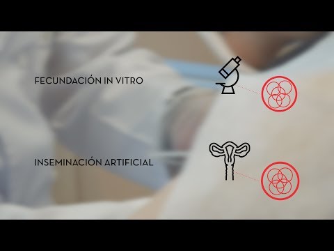 Vídeo: Diferencia Entre Inseminación Artificial Y Fertilización In Vitro