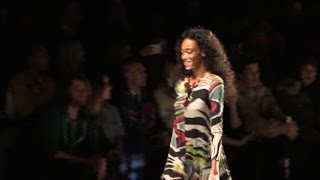 Canadian Model With Vitiligo Who Inspires Fashion World