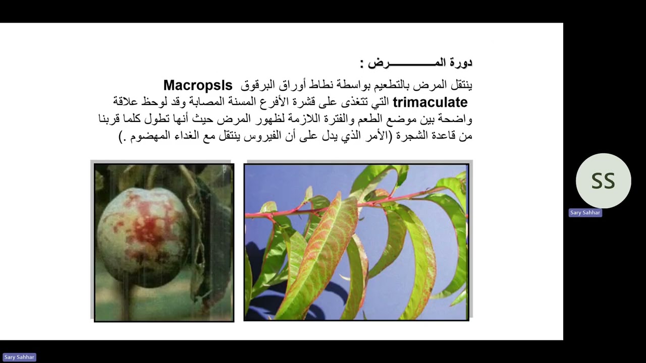 أحياء دقيقة المحاضرة الحادية عشر نظري