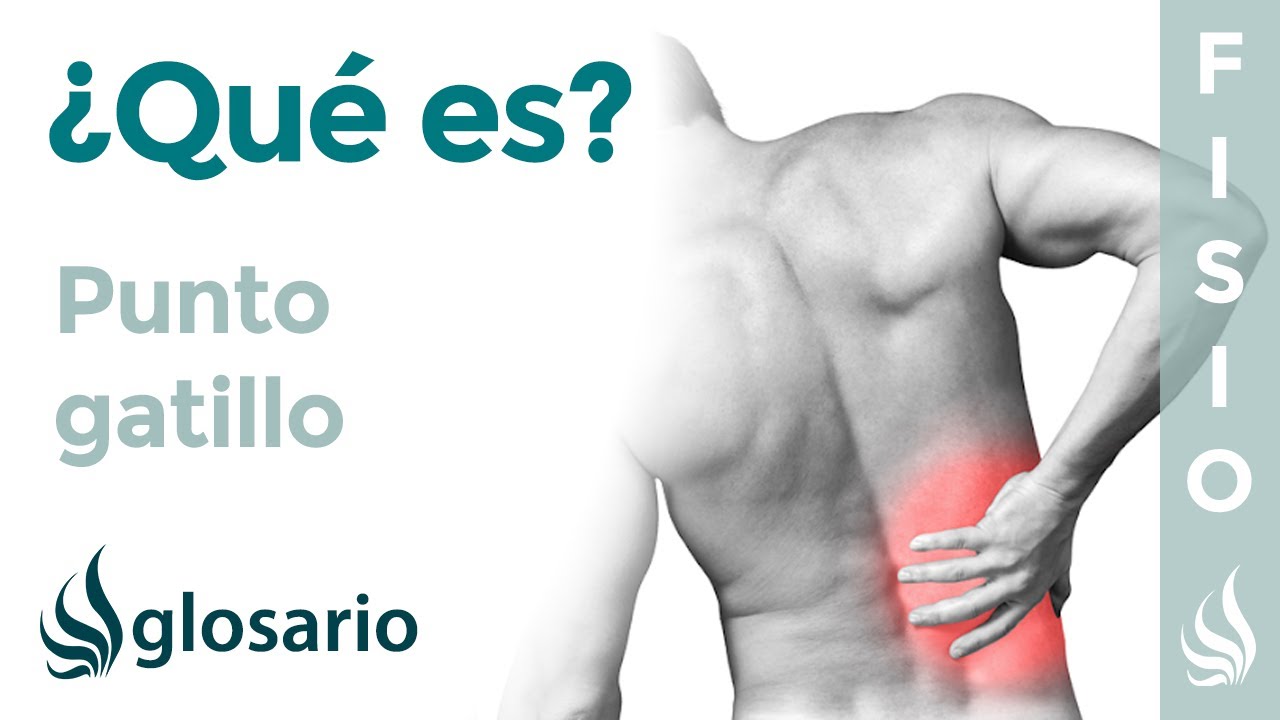 PUNTO GATILLO | Qué es, qué afecta, síntomas, signos clínicos, causas y