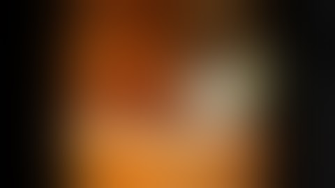 Peroral Cholangioscopy in Billroth II Anatomy