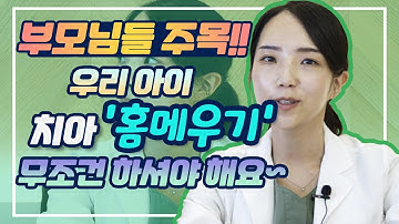 우리아이 충치예방을 위한 