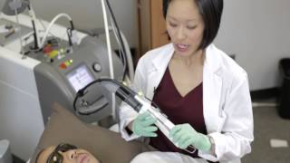 Laser Hair Removal with NdYAG 1064nm Laser, Skin Type IV VI