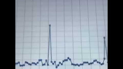 EKG Sensor Stop Motion Animation