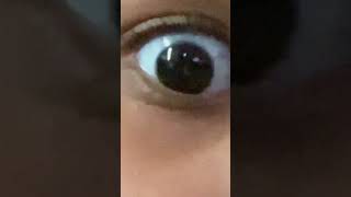 Rest Your Eyes And Let People Guess Your Truma