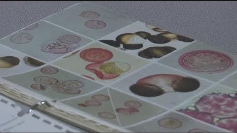 A pollen explosion is right around the corner
