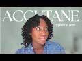 My Accutane Experience: Acne Journey, Side Effects, Meals &amp; Products to Use | 2 Months In