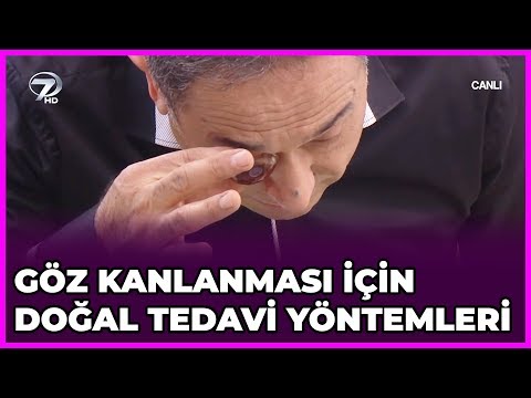 Video: Yetişkinlerde Göz Tembelliğini Doğal Olarak Tedavi Etmenin 3 Basit Yolu